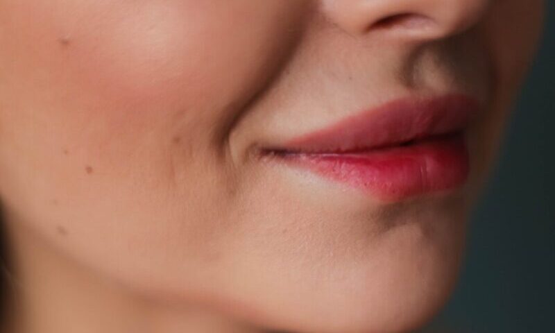flacidez facial